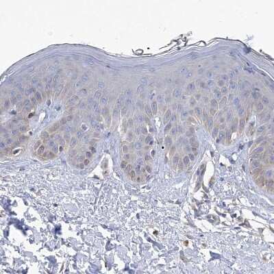 Immunohistochemistry-Paraffin: Spermine synthase Antibody [NBP1-87812]