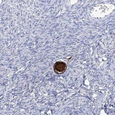 Immunohistochemistry-Paraffin: Spermine synthase Antibody [NBP1-87813]