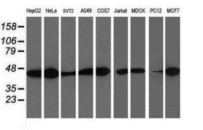 Western Blot: Spermine synthase Antibody (OTI3C9)Azide and BSA Free [NBP2-74318]