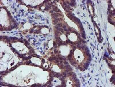 Immunohistochemistry-Paraffin: Spermine synthase Antibody (OTI3C9) [NBP2-00900]