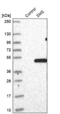 Western Blot: Spermine synthase Antibody [NBP1-87813]