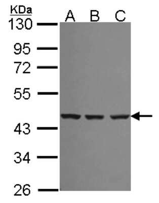 Western Blot: Spermine synthase Antibody [NBP2-20470]