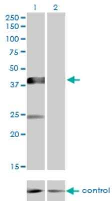 Western Blot: Sphingomyelin Synthase 2 Antibody (7D10) [H00166929-M08]