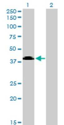 Western Blot: Sphingomyelin Synthase 2 Antibody (7D10) [H00166929-M08]