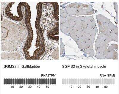 Immunohistochemistry-Paraffin: Sphingomyelin Synthase 2 Antibody [NBP1-92436]