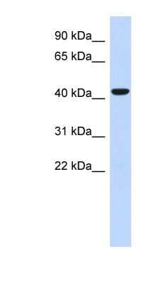 Western Blot: Sphingomyelin Synthase 2 Antibody [NBP1-60004]