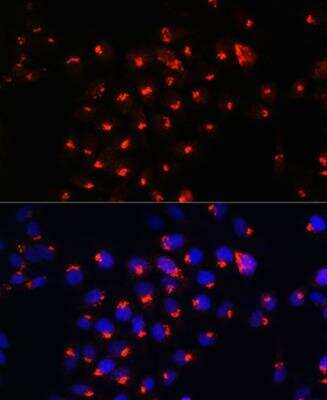 Immunocytochemistry/ Immunofluorescence: Sphingomyelin synthase 1 Antibody - Azide and BSA Free [NBP2-93903]