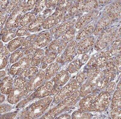 Immunohistochemistry-Paraffin: Sphingomyelin synthase 1 Antibody [NBP1-92435]