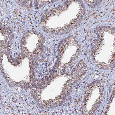 Immunohistochemistry-Paraffin: Sphingomyelin synthase 1 Antibody [NBP1-92435]