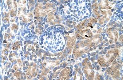 Immunohistochemistry-Paraffin: Sphingosine 1 phosphate phosphatase 2 Antibody [NBP1-53181]