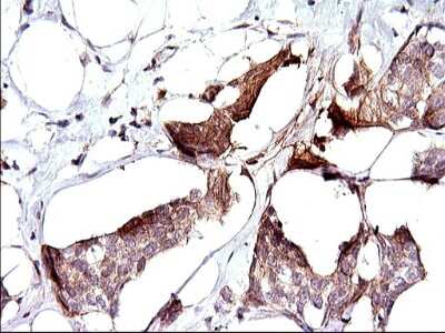 Immunohistochemistry: Sphingosine Kinase 1/SPHK1 Antibody (OTI1A6) [NBP2-45944]
