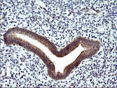 Immunohistochemistry: Sphingosine Kinase 1/SPHK1 Antibody (OTI1A6) [NBP2-45944]