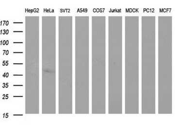 Western Blot: Sphingosine Kinase 1/SPHK1 Antibody (OTI1A6) [NBP2-45944]