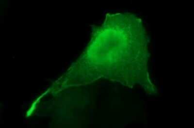 Immunocytochemistry/ Immunofluorescence: Sphingosine Kinase 1/SPHK1 Antibody (OTI1A6) - Azide and BSA Free [NBP2-74332]