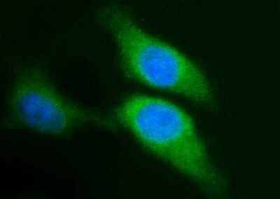 Immunocytochemistry/ Immunofluorescence: Sphingosine Kinase 1/SPHK1 Antibody (OTI1A6) - Azide and BSA Free [NBP2-74332]