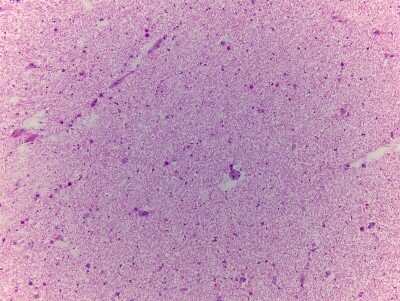 Hematoxylin & Eosin Stain: Spinal Cord Tissue Slides (Adult Normal)- Frozen [NBP2-77559]