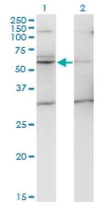 Western Blot: Spinesin Antibody (2E5) [H00080975-M09]