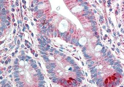 Immunohistochemistry-Paraffin: Spinesin Antibody [NB100-896]