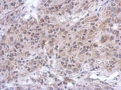 Immunohistochemistry-Paraffin: Spinesin Antibody [NBP2-20474]