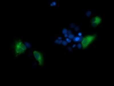 Immunocytochemistry/ Immunofluorescence: Spinesin Antibody (OTI4G4) - Azide and BSA Free [NBP2-74337]