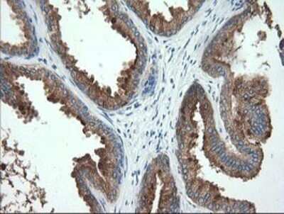 Immunohistochemistry: Spinesin Antibody (OTI4G4) [NBP2-46142]