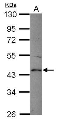Western Blot: Spinesin Antibody [NBP2-20474]