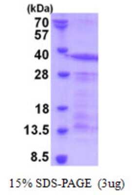 SDS-PAGE: Recombinant Human CD43/Sialophorin His Protein [NBP2-23472]