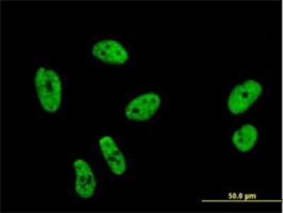 Immunocytochemistry/ Immunofluorescence: Splicing Factor 1 Antibody (2E12) [H00007536-M01]