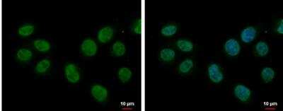 Immunocytochemistry/ Immunofluorescence: Splicing Factor 1 Antibody [NBP1-32583]
