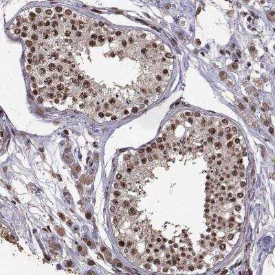 Immunohistochemistry-Paraffin: Splicing Factor 1 Antibody [NBP1-86835]