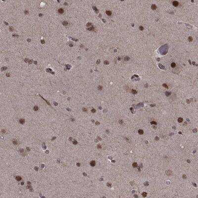 Immunohistochemistry-Paraffin: Splicing Factor 1 Antibody [NBP1-86835]