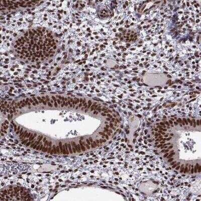 Immunohistochemistry-Paraffin: Splicing Factor 1 Antibody [NBP1-86835]