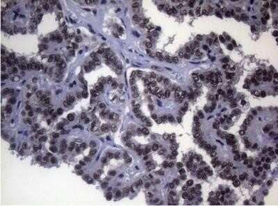 Immunohistochemistry: Splicing Factor 1 Antibody (OTI7H9) - Azide and BSA Free [NBP2-74338]