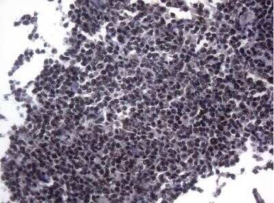 Immunohistochemistry: Splicing Factor 1 Antibody (OTI7H9) - Azide and BSA Free [NBP2-74338]