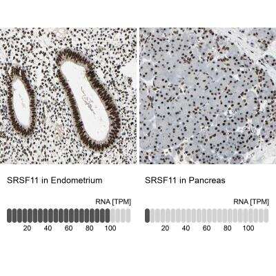 Immunohistochemistry-Paraffin: Splicing factor, arginine/serine-rich 11 Antibody [NBP1-87381]