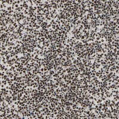 Immunohistochemistry-Paraffin: Splicing factor, arginine/serine-rich 11 Antibody [NBP1-87381]