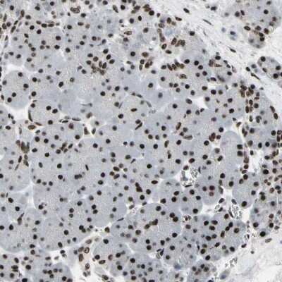 Immunohistochemistry-Paraffin: Splicing factor, arginine/serine-rich 11 Antibody [NBP1-87381]