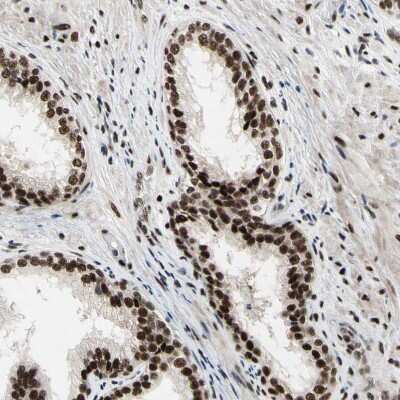 Immunohistochemistry-Paraffin: Splicing factor, arginine/serine-rich 11 Antibody [NBP1-87381]