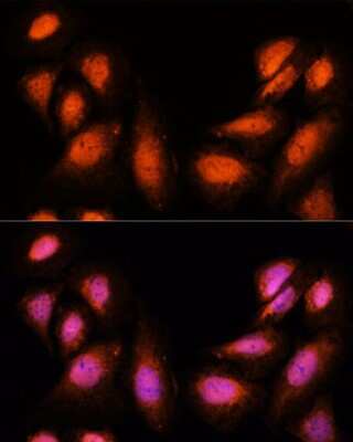 Immunocytochemistry/ Immunofluorescence: Spt6 Antibody - Azide and BSA Free [NBP2-93722]