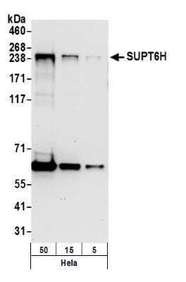 Western Blot: Spt6 Antibody [NB100-2583]