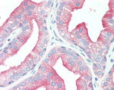 Immunohistochemistry: Src Antibody (5A18) [NBP1-19188]