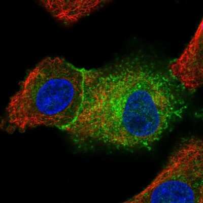 Immunocytochemistry/ Immunofluorescence: Src Antibody [NBP2-38165]