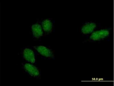 Immunocytochemistry/ Immunofluorescence: Ssu72 Antibody [H00029101-B01P]