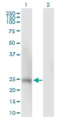 Western Blot: Ssu72 Antibody [H00029101-B01P]