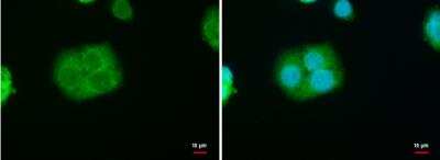 Immunocytochemistry/ Immunofluorescence: StAR Antibody [NBP1-33485]