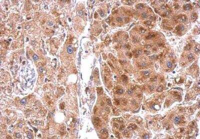 Immunohistochemistry-Paraffin: StAR Antibody [NBP1-33485]