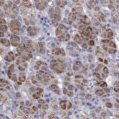 Immunohistochemistry-Paraffin: StAR Antibody [NBP1-86992]