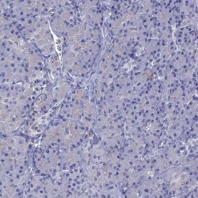 Immunohistochemistry-Paraffin: StAR Antibody [NBP1-86992]