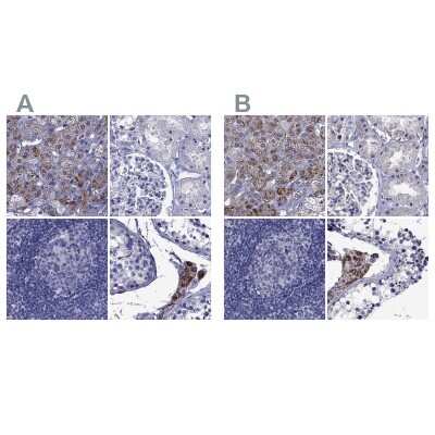 Immunohistochemistry-Paraffin: StAR Antibody [NBP1-86992]