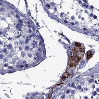 Immunohistochemistry-Paraffin: StAR Antibody [NBP1-86992]
